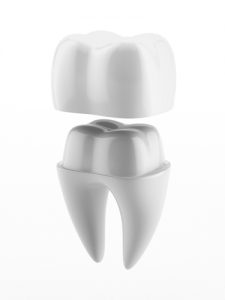 Porcelain Crowns Plymouth Dnentist